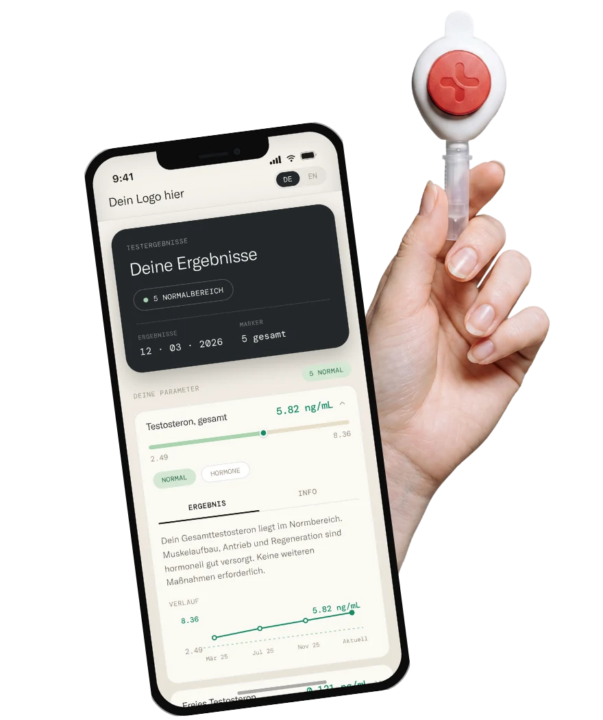 Eine Hand hält den Remi-Health-Fingerstich-Collector neben dem Kundenportal auf einem Smartphone